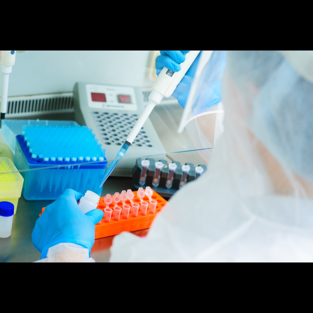 AZF System Ysize:chromosome Real Time PCR test for detection of the microdeletions in AZF regions: AZFa  sY84, sY86 , AZFb  sY127, sY134 , AZFc  sY254, sY255  of the human Y