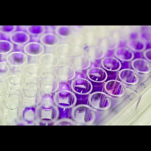 [0338-SEC684Hu-96T] ELISA Kit for 2',5'size:Oligoadenylate Synthetase 1  OAS1 